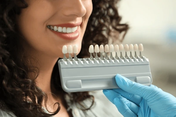 dental veneers in orlando, fl