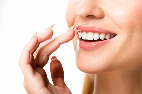take home whitening in orlando, fl