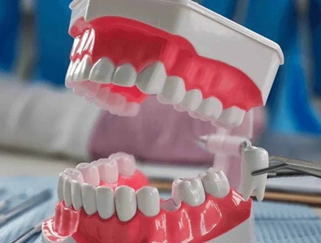 tooth extraction in orlando, fl